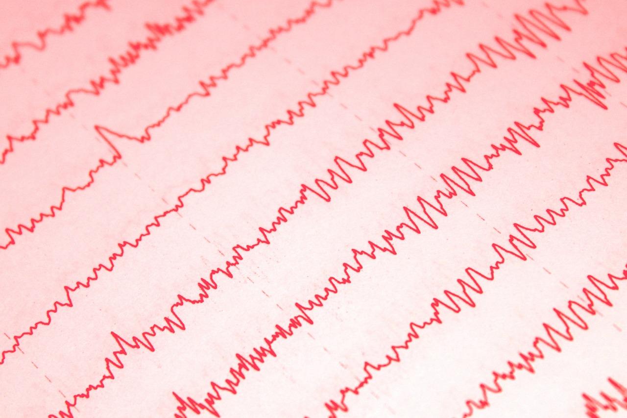 Registro gráfico de un electroencefalograma (EEG) mostrando la actividad eléctrica cerebral a través de ondas y picos.