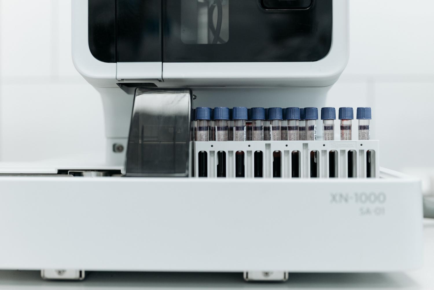 Automated laboratory equipment processing blood samples for protein analysis to diagnose multiple myeloma.