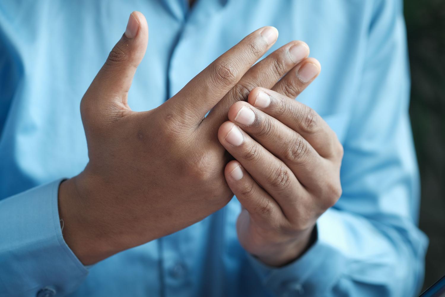 Primer plano de una persona sosteniendo su mano con dolor, ilustrando la rigidez y el malestar articular característico de la artritis reumatoide