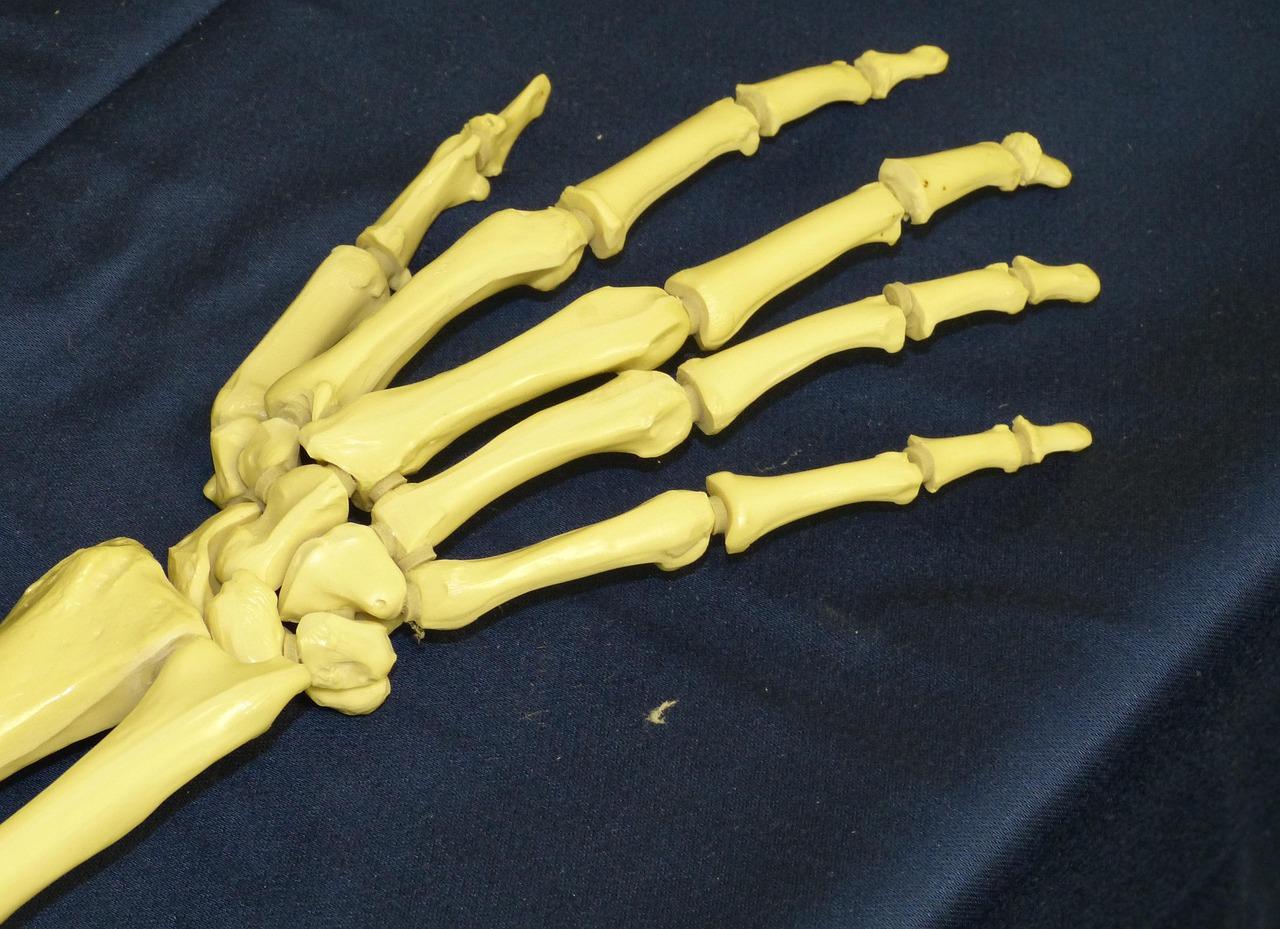 Modelo anatómico de la estructura ósea de la mano humana, señalando las articulaciones vulnerables al ataque autoinmune